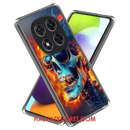 Kuori Xiaomi Redmi Note 14 Pro 4g Liekehtivä Kallo Suojakuori